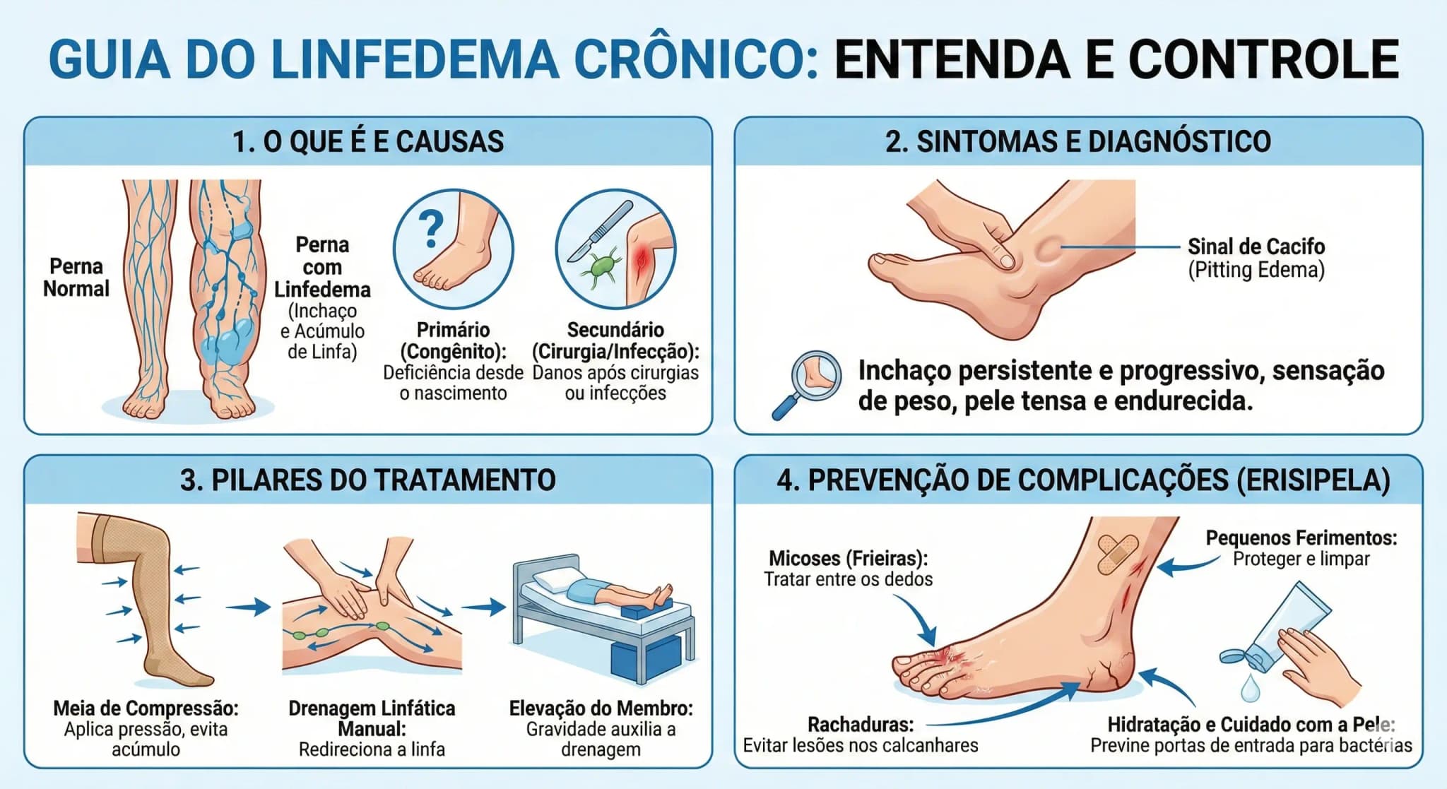 Infográfico explicativo sobre Linfedema Crônico