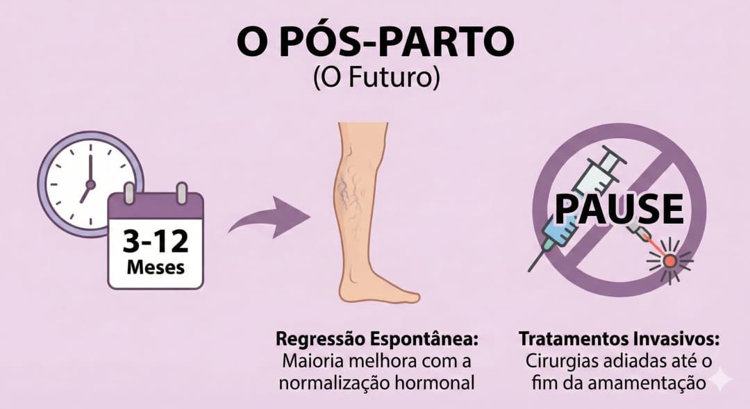 O pós-parto e regressão das varizes