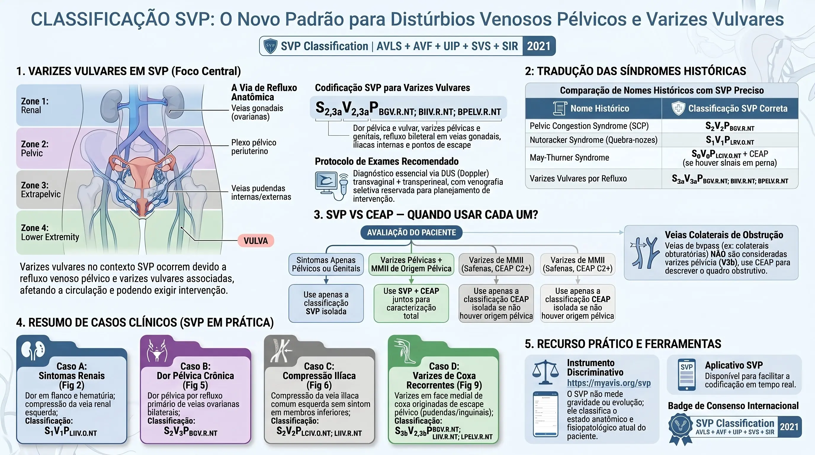 Infográfico: Aplicação do SVP nas Varizes Vulvares e Casos Clínicos AVLS 2021. Oito exemplos com classificação SVP e regras SVP vs CEAP.