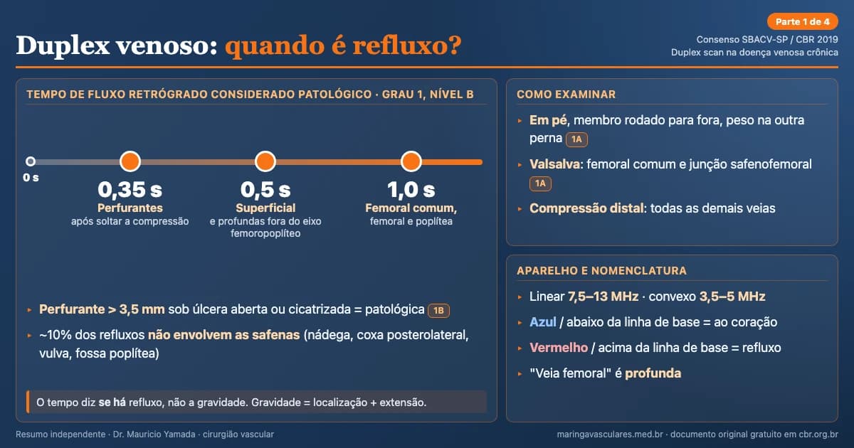 Infográfico: critérios de refluxo no duplex venoso segundo o Consenso SBACV-SP/CBR 2019. Refluxo em perfurantes acima de 0,35 segundo, no sistema superficial e nas veias profundas fora do eixo femoropoplíteo acima de 0,5 segundo, e na femoral comum, femoral e poplítea acima de 1,0 segundo. Exame em ortostase, Valsalva na junção safenofemoral, compressão distal nas demais veias e convenções de cor do Doppler.