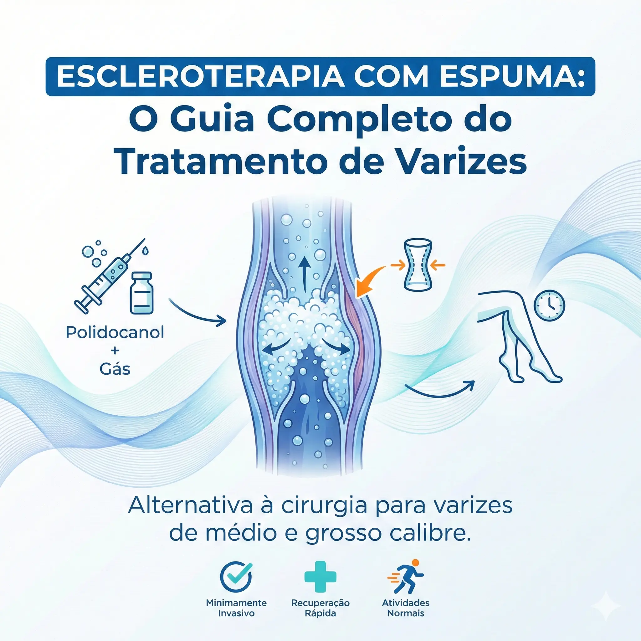 Guia Completo de Escleroterapia com Espuma