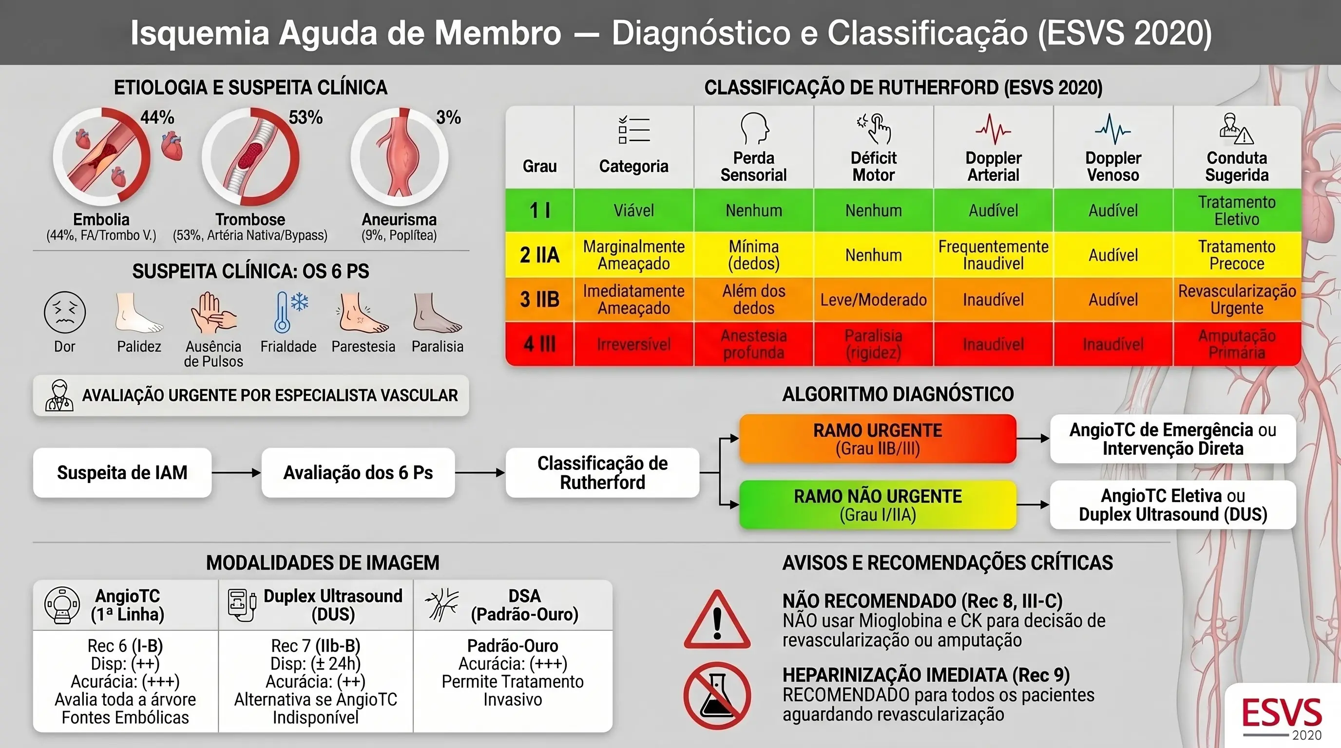 Infográfico: Isquemia Aguda de Membro — Classificação de Rutherford e Diagnóstico. ESVS 2020. Graus I, IIA, IIB, III com critérios clínicos e imagem.
