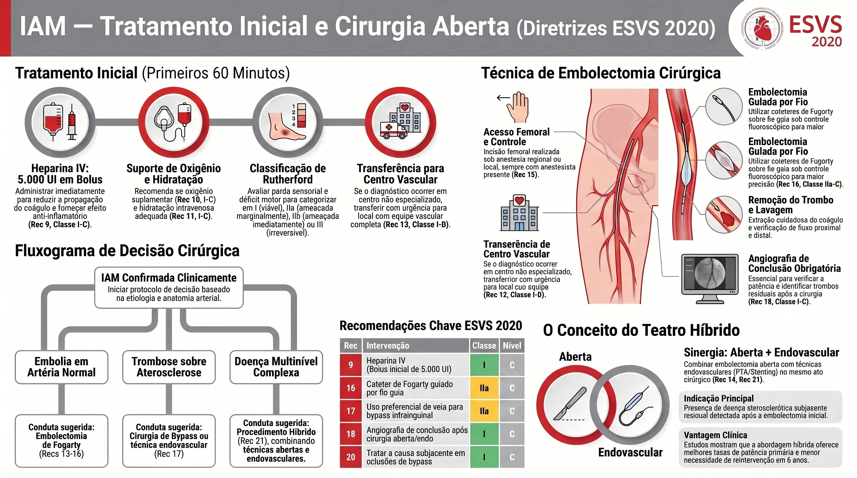 Infográfico: Tratamento Inicial e Cirurgia Aberta na IAM ESVS 2020. Heparina IV, embolectomia Fogarty, angiografia de conclusão, bypass venoso, teatro híbrido.