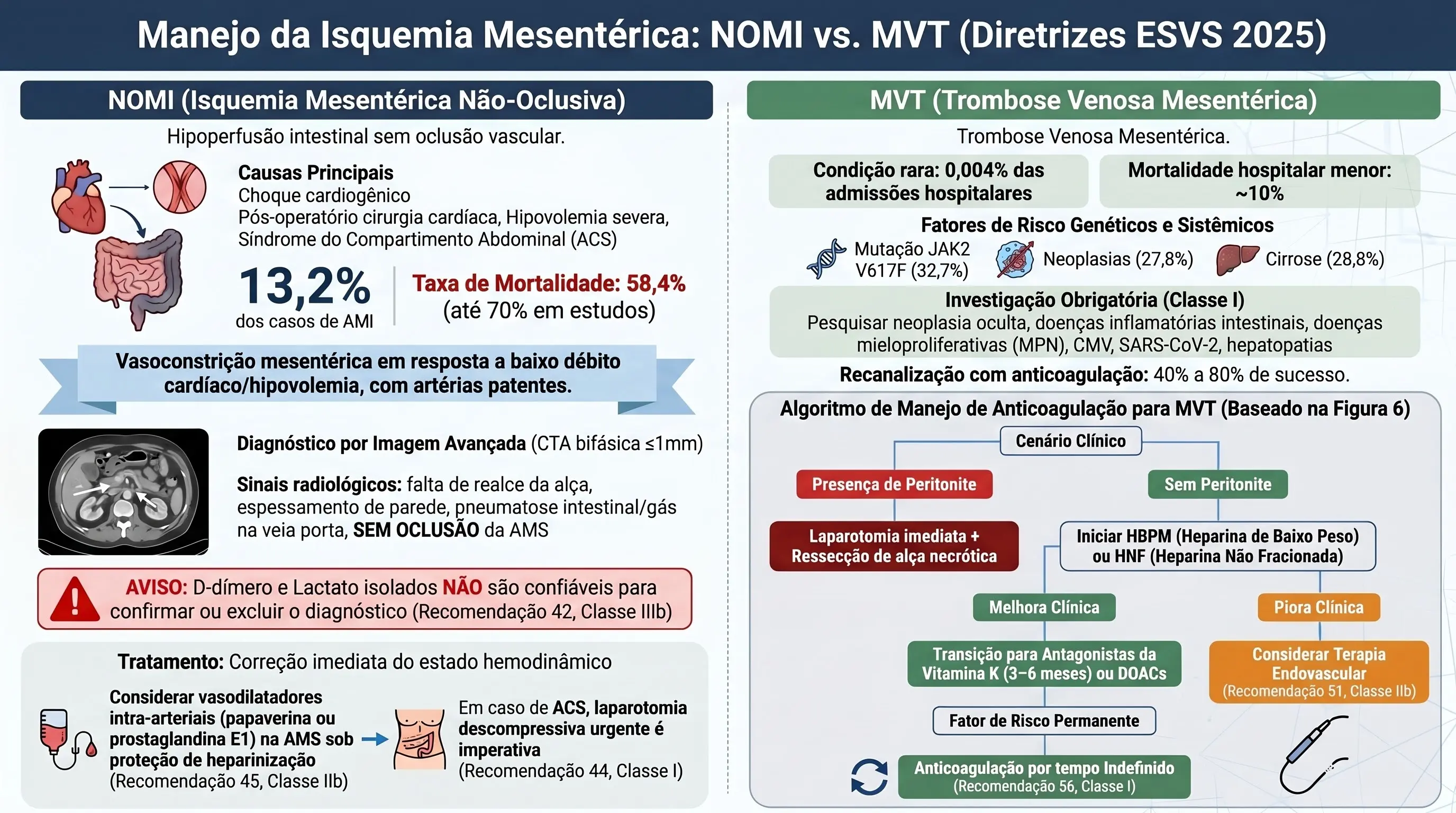 Infográfico: NOMI e Trombose Venosa Mesentérica — ESVS 2025. Causas NOMI, laparotomia descompressiva, JAK2 em 32,7% MVT, algoritmo anticoagulação, DOACs como alternativa. Recs 42-56.