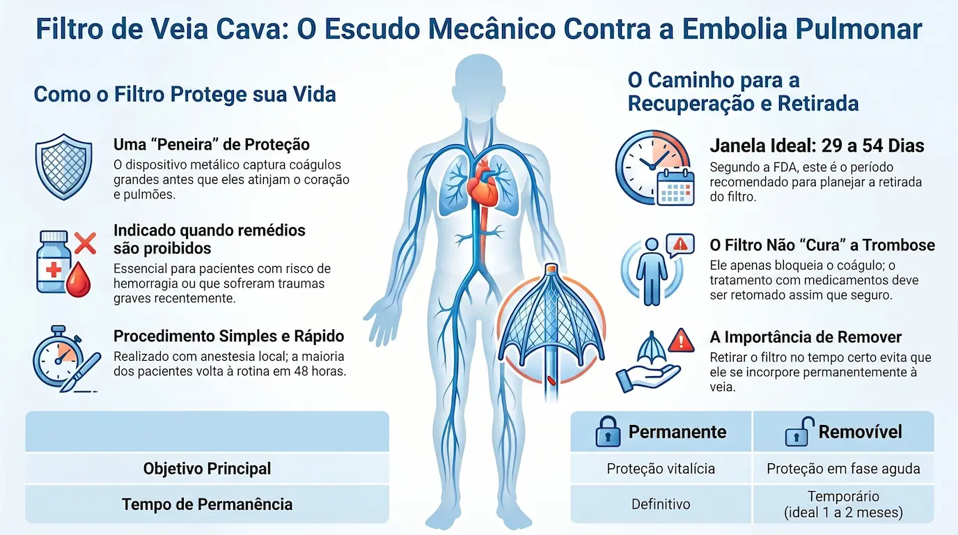 Infográfico: Filtro de Veia Cava — como protege, indicações, filtro permanente vs. removível, janela de retirada 29-54 dias