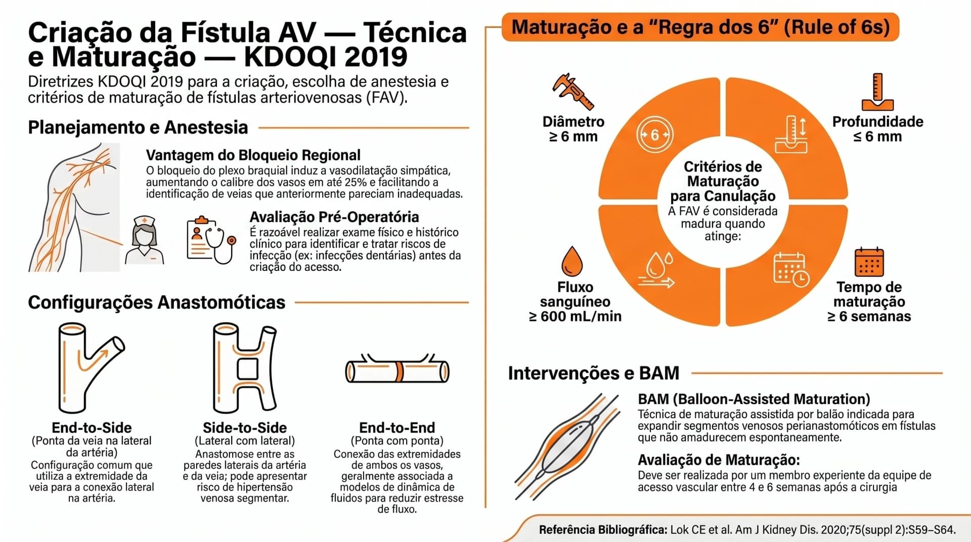 Infográfico KDOQI 2019 — Criação da Fístula AV: Técnica e Maturação