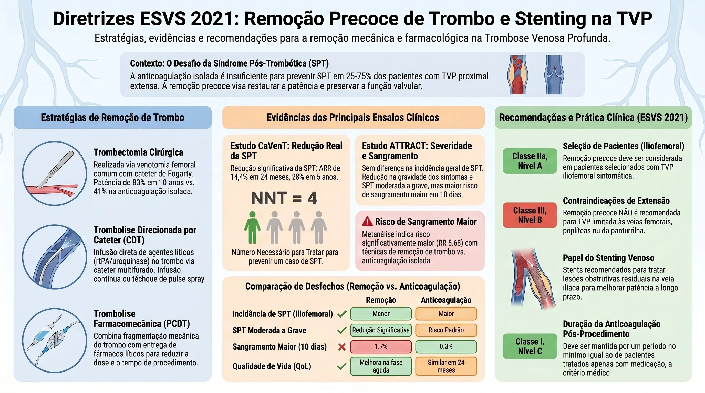 Infográfico: Remoção Precoce de Trombo e Stenting Venoso no Tratamento da TVP — Diretrizes ESVS 2021. Mostra os fundamentos fisiopatológicos (taxas de recanalização de ~80% nas veias da panturrilha vs. ~20% nos segmentos ilíacos, obstrução e refluxo como motores da síndrome pós-trombótica, e a Síndrome de May-Thurner), as estratégias de remoção de trombo (trombectomia cirúrgica, trombólise direcionada por cateter — CDT, e trombólise farmacomecânica direcionada por cateter — PCDT), as evidências dos estudos ATTRACT, CAVENT, CAVA e TORPEDO, os procedimentos adjuvantes (stenting venoso, fístula arteriovenosa e anticoagulação pós-intervenção) e o caminho diagnóstico pré-intervenção (Escore de Wells, WLUS, Venografia por TC ou RM).