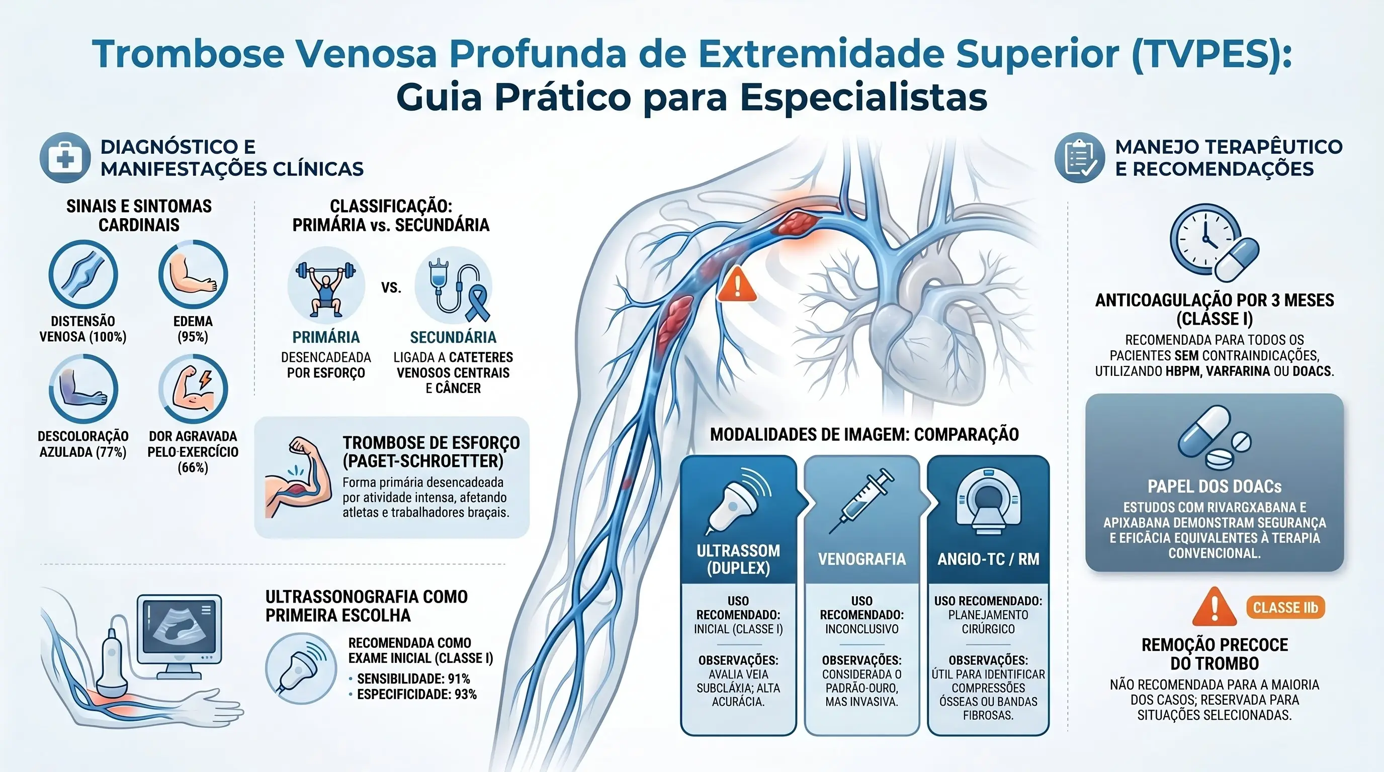 Infográfico: Trombose Venosa Profunda de Extremidade Superior (TVPES) — Guia Prático para Especialistas, Diretrizes ESVS 2021. Mostra os sinais e sintomas cardinais (distensão venosa 100%, edema 93%, descoloração azulada 77%, dor agravada pelo exercício 66%), a classificação primária (trombose de esforço/Paget-Schroetter) vs. secundária (cateteres venosos centrais e câncer), a ultrassonografia como primeira escolha (Classe I, Nível C, sensibilidade 91%, especificidade 93%), a comparação entre modalidades de imagem (ultrassom Duplex, venografia e angio-TC/RM) e o manejo terapêutico (anticoagulação por 3 meses Classe I, Nível C, com HBPM, varfarina ou DOACs, papel dos DOACs como rivaroxabana e apixabana, remoção precoce do trombo não recomendada na maioria dos casos Classe III e trombólise em casos selecionados nas primeiras 2 semanas Classe IIb).