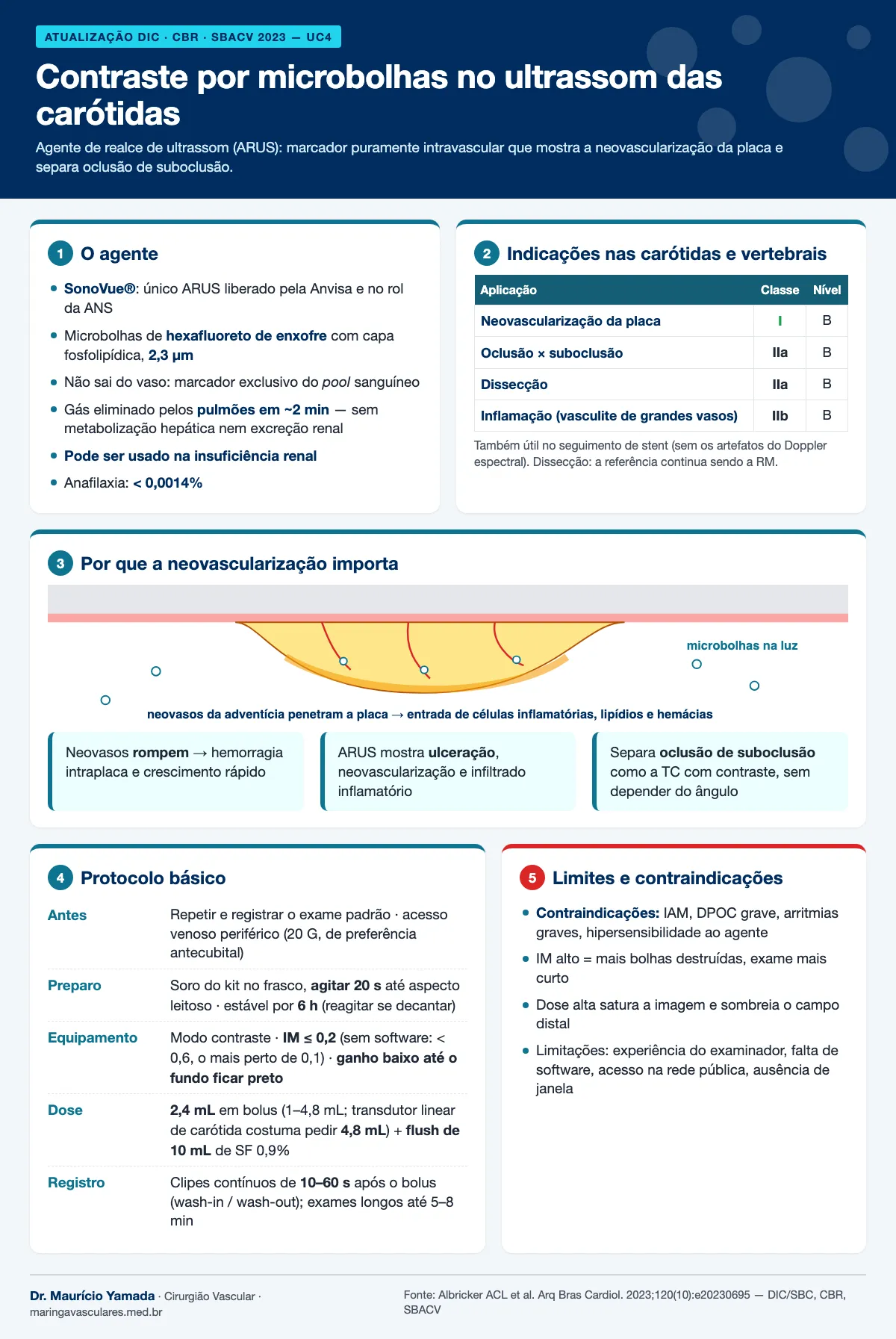Infográfico: o agente SonoVue, indicações com classe de recomendação, neovascularização e protocolo do exame contrastado