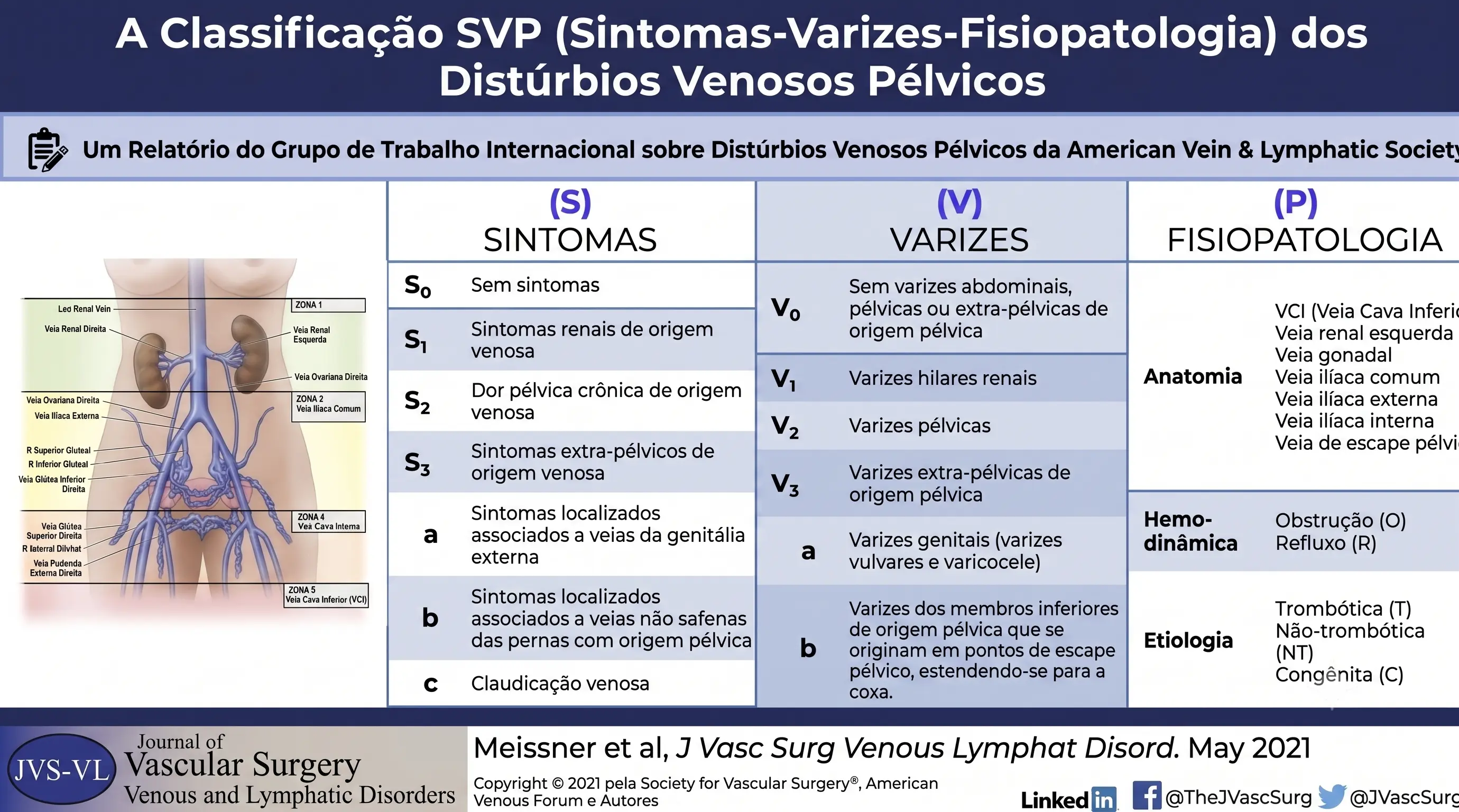 Tabela da Classificação SVP dos Distúrbios Venosos Pélvicos — Sintomas (S), Varizes (V) e Fisiopatologia (P). AVLS 2021.